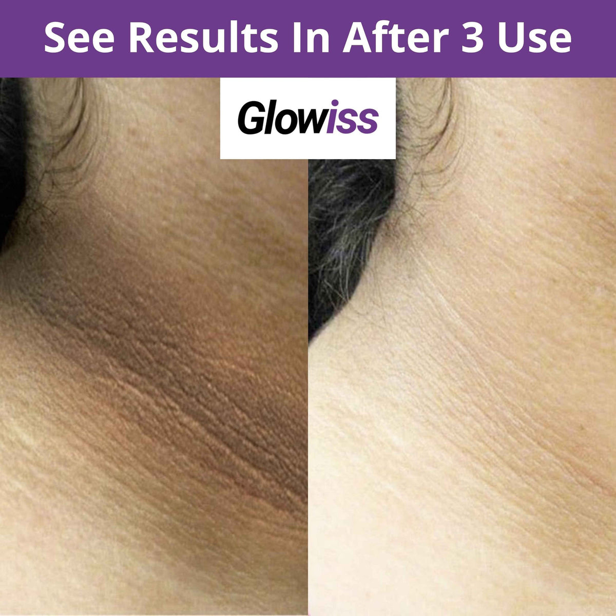 Orange Exfoliating Dead Skin Remover & Brightening Gel